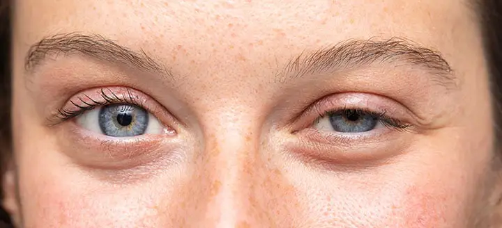 Using an eyelash curler every day can increase the risk of an eye infection